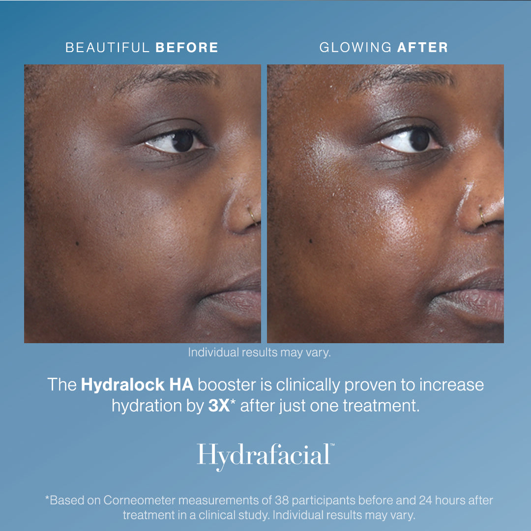 Hydralock HA Booster