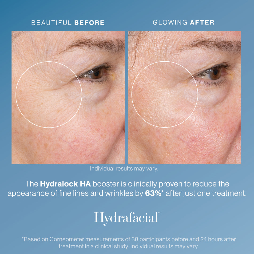 Hydralock HA Booster