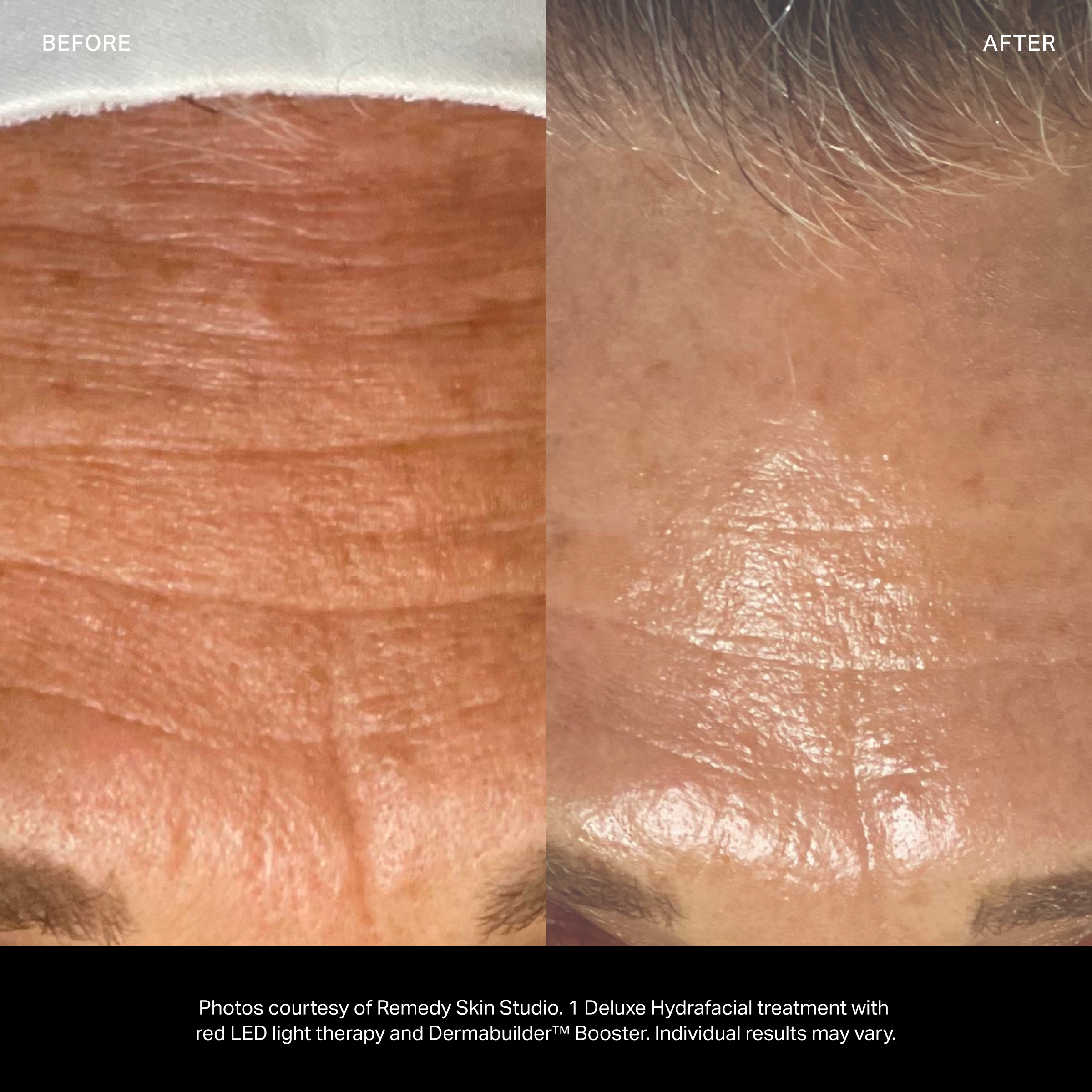 Dermabuilder™ Booster