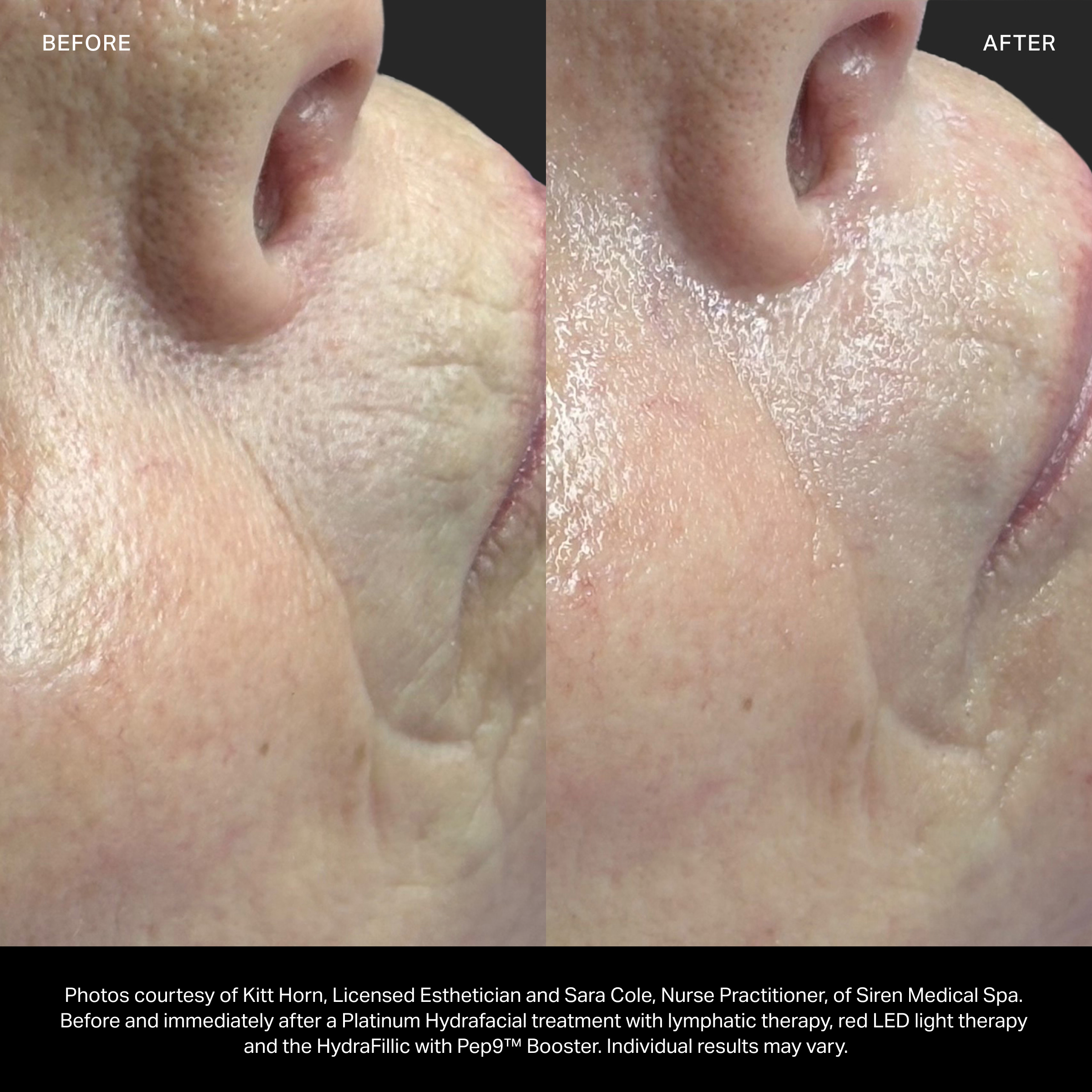 HydraFillic with Pep9™ Booster