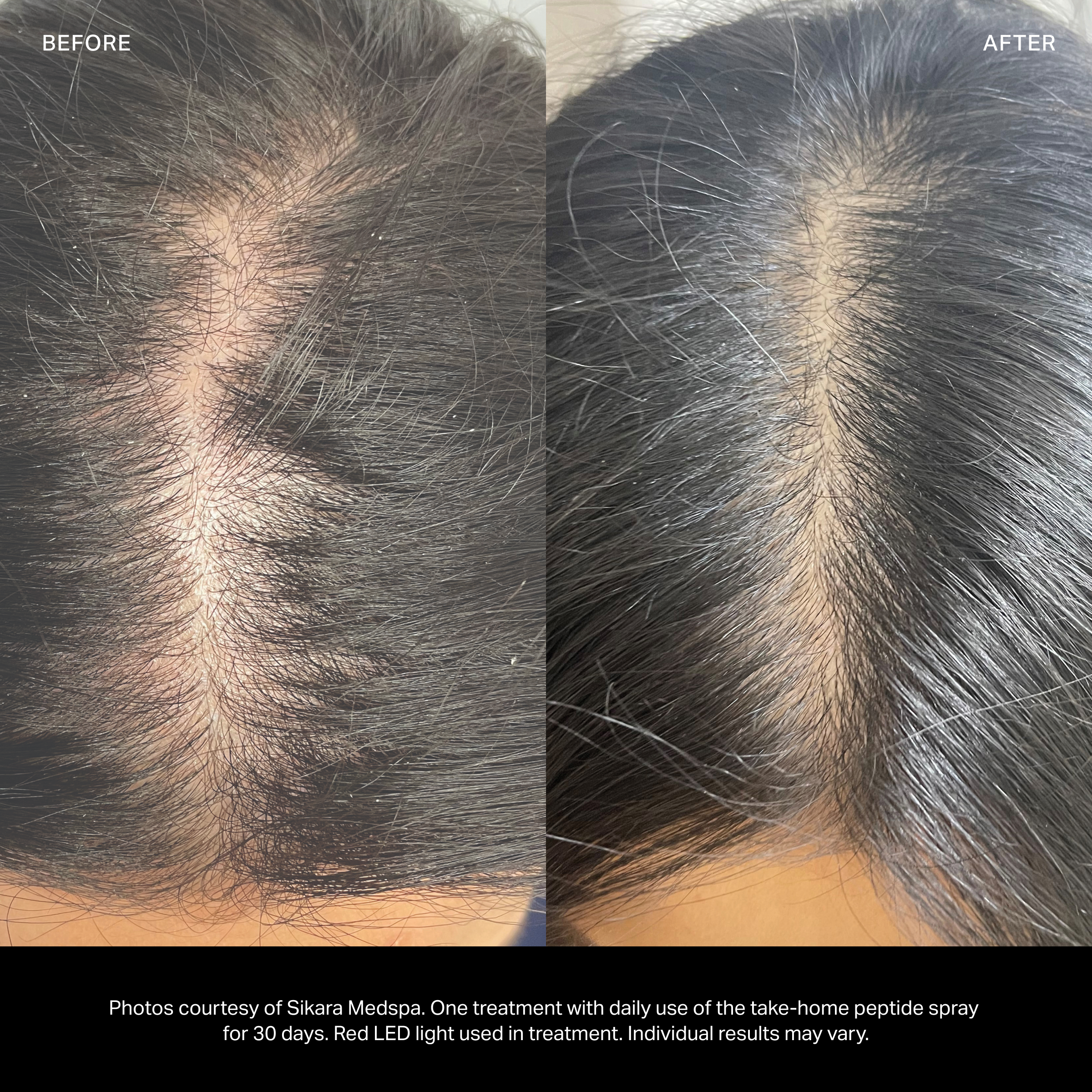 HydraScalp with Keravive™ Peptide Complex Spray