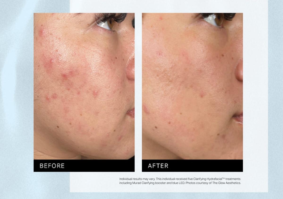 Murad Clarifying Booster